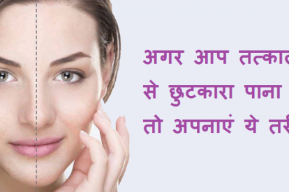 आयुर्वेदिक टिप्स | ayurvedic beauty tips in hindi